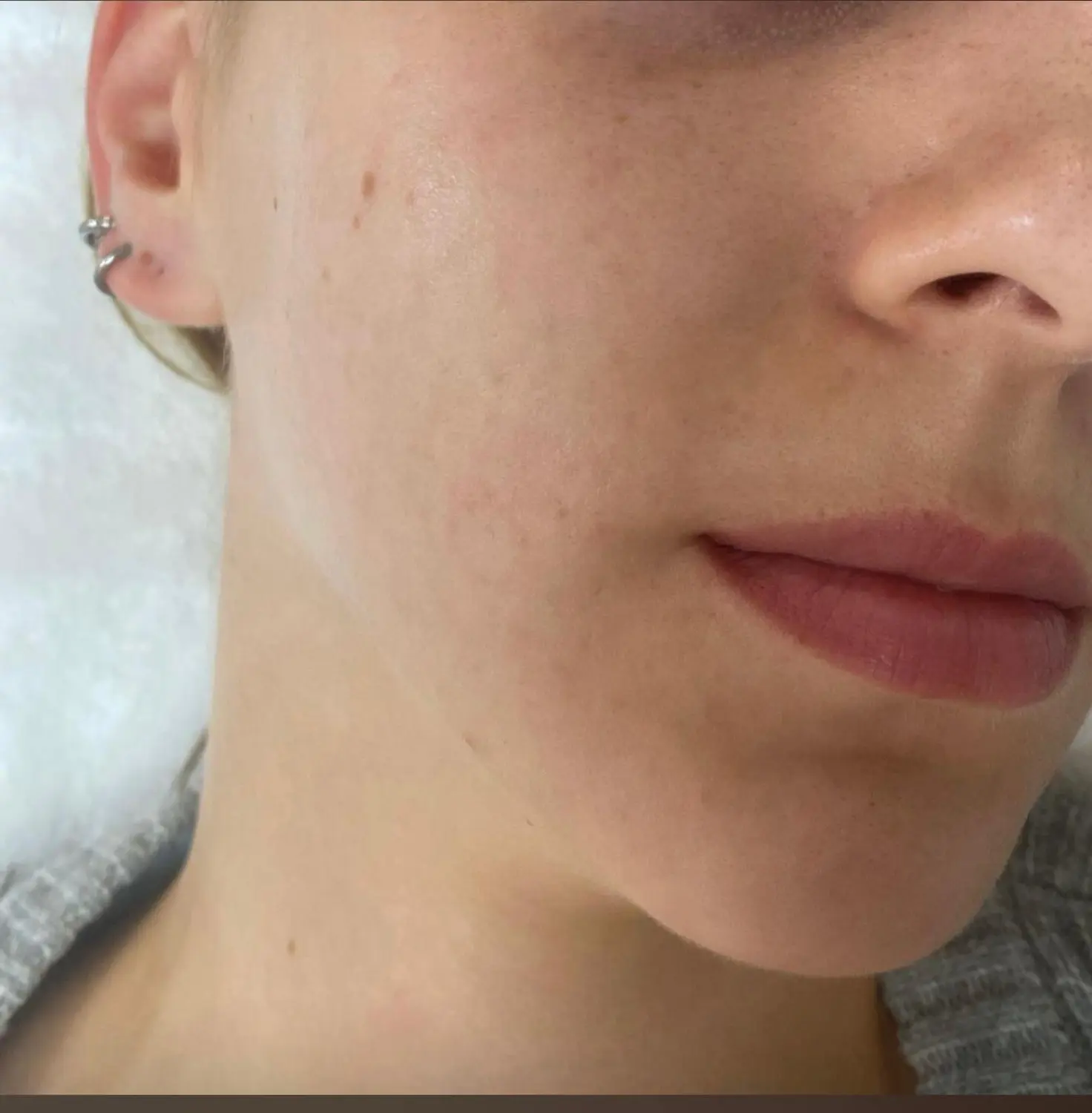 OxyGeneo-Behandlung von VS Kosmetik